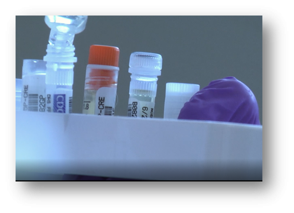 Sample bottles